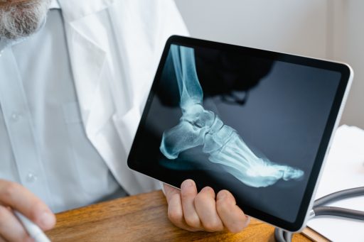 Representación de una radiografía mostrando los huesos de la articulación del tobillo.